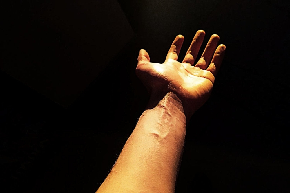 A hand exposed by sunlight